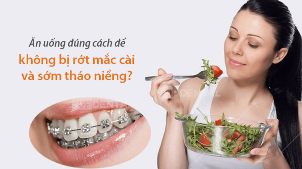 Niềng răng có khó ăn không?